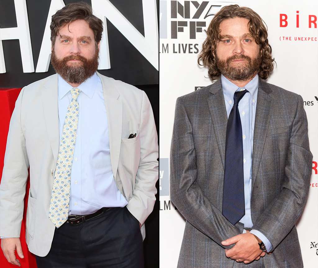 Zach Galifianakis