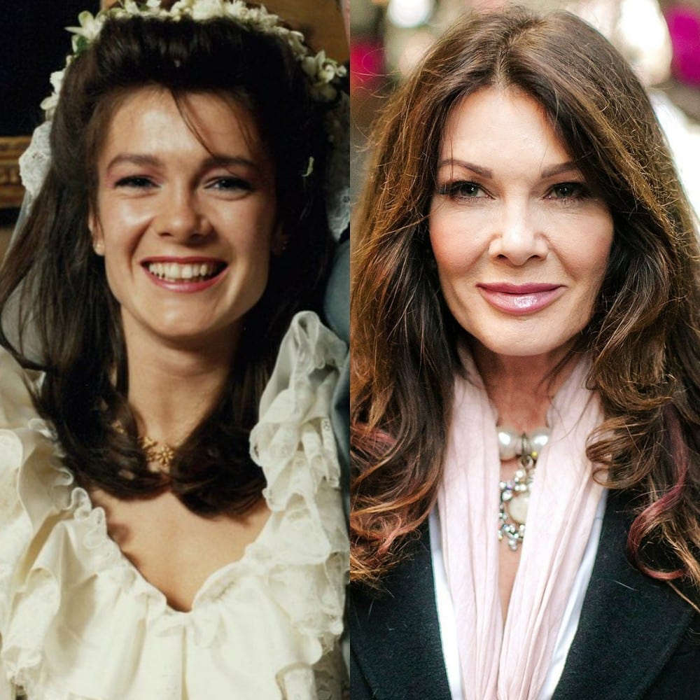 Lisa Vanderpump Plastic Surgery Before And After Celebrity Surgeries   8. Lisa Vanderpump 